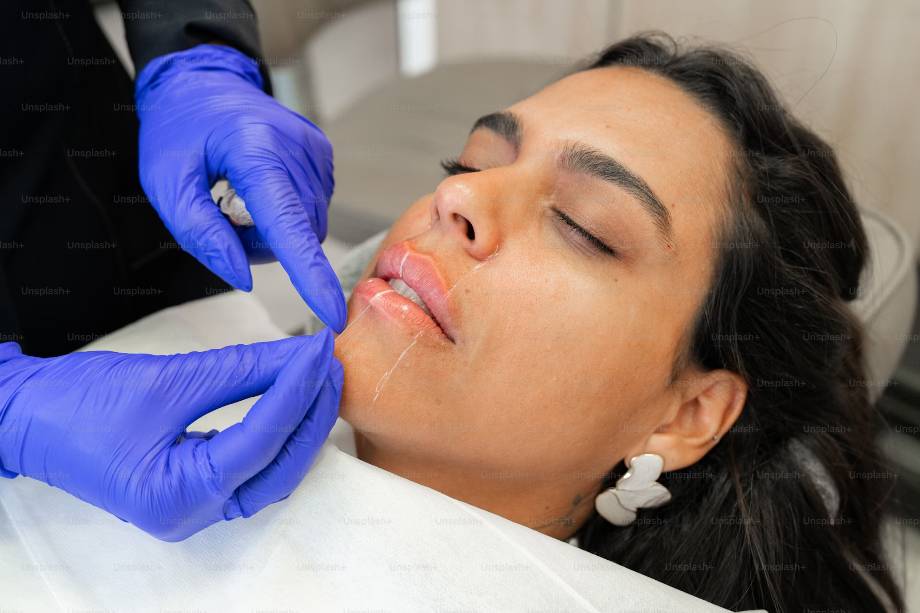 prepare for Botox
